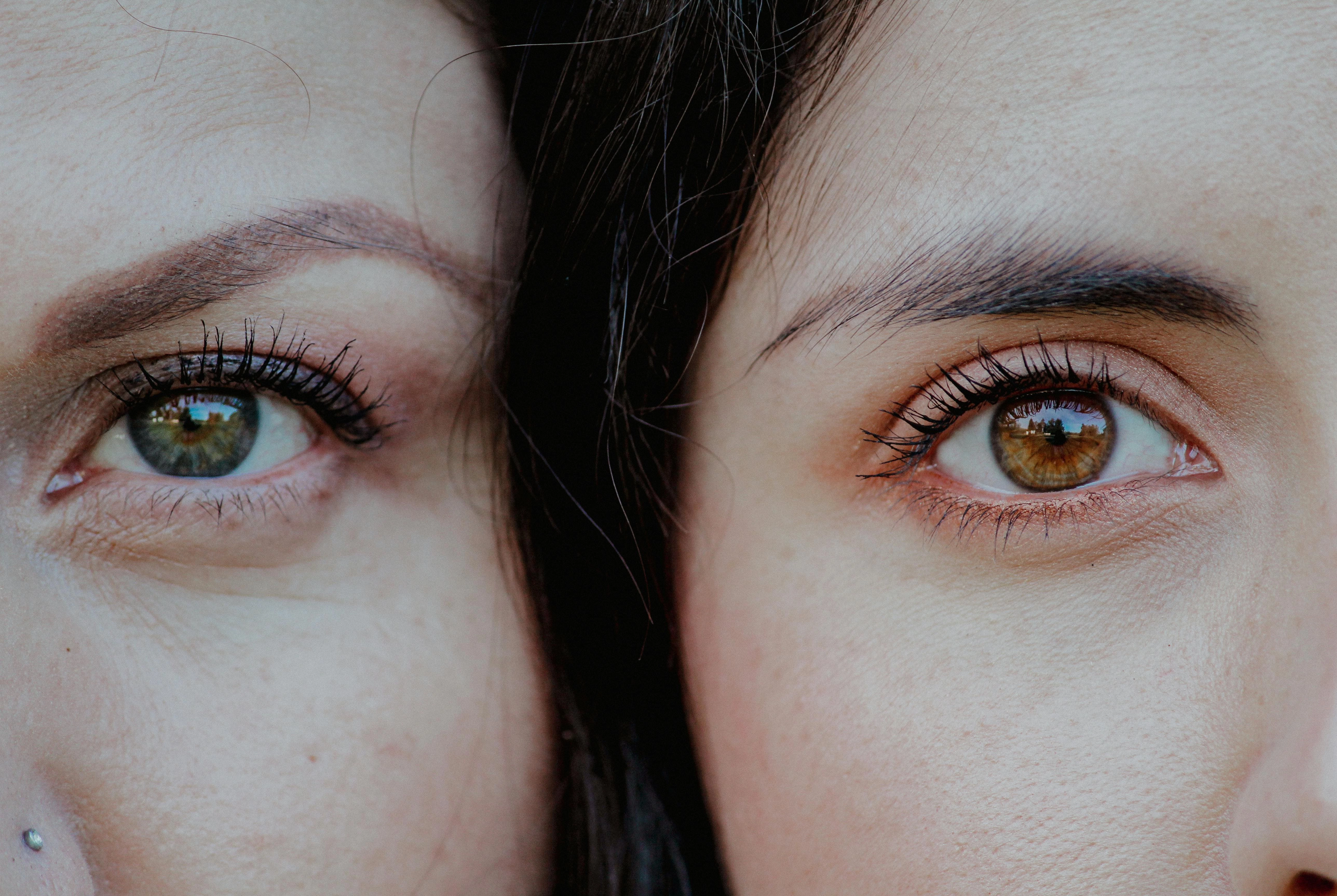 Blepharoplasty (Upper & Lower)